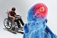 این بیماری، خود ایمنی جوانان را بیشتر مبتلا می‌کند